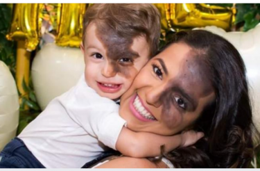 Mãe faz a mesma marca de nascença do filho para lhe ensinar amor próprio