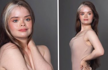 Jessica, a modelo com Down que conquistou passarelas e campanhas